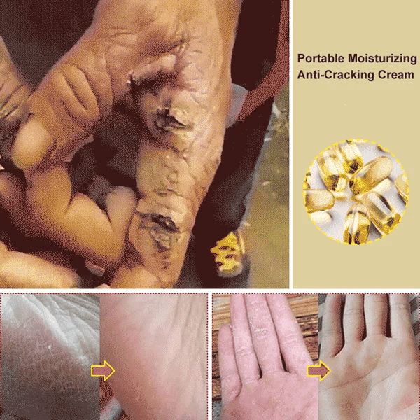 Winter Cracked Skin Repair Cream