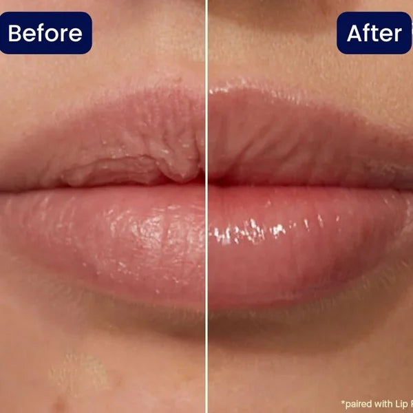 Vitamin E Lip Serum