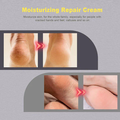 Winter Cracked Skin Repair Cream